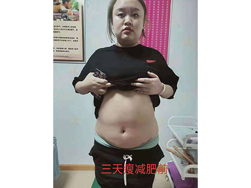 湖南宏鼎腾达生物科技有限责任公司,七日瘦,长沙哪里可以减肥,哪里减肥效果好,减肥塑形,三天嗖,三天瘦