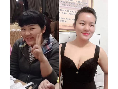 湖南宏鼎腾达生物科技有限责任公司,七日瘦,长沙哪里可以减肥,哪里减肥效果好,减肥塑形,三天嗖,三天瘦