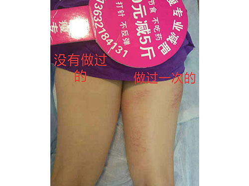 湖南宏鼎腾达生物科技有限责任公司,七日瘦,长沙哪里可以减肥,哪里减肥效果好,减肥塑形,三天嗖,三天瘦