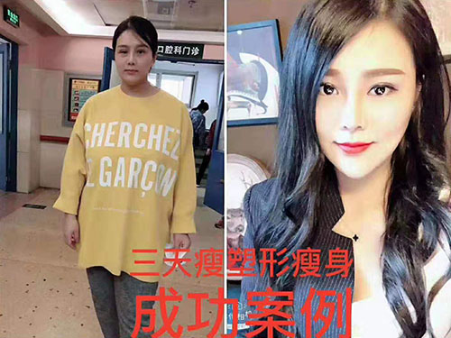 湖南宏鼎腾达生物科技有限责任公司,七日瘦,长沙哪里可以减肥,哪里减肥效果好,减肥塑形,三天嗖,三天瘦
