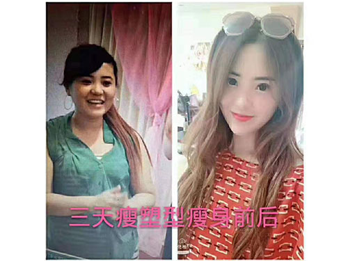 湖南宏鼎腾达生物科技有限责任公司,七日瘦,长沙哪里可以减肥,哪里减肥效果好,减肥塑形,三天嗖,三天瘦